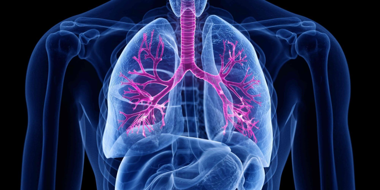 Everything You Need to Know About COPD