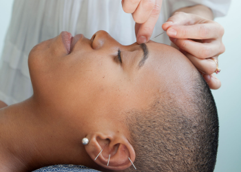10 Health Benefits of Acupuncture And a Few Minor Risks to Consider