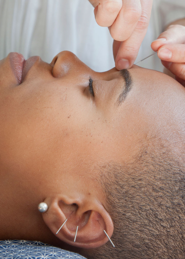 10 Health Benefits of Acupuncture And a Few Minor Risks to Consider