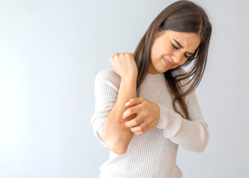 4 Foods That Help Manage Psoriasis