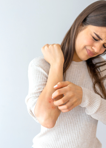 4 Foods That Help Manage Psoriasis