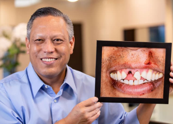 Considering Dental Implants? Here’s What They Should Cost You!