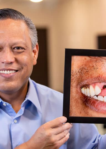 Considering Dental Implants? Here’s What They Should Cost You!